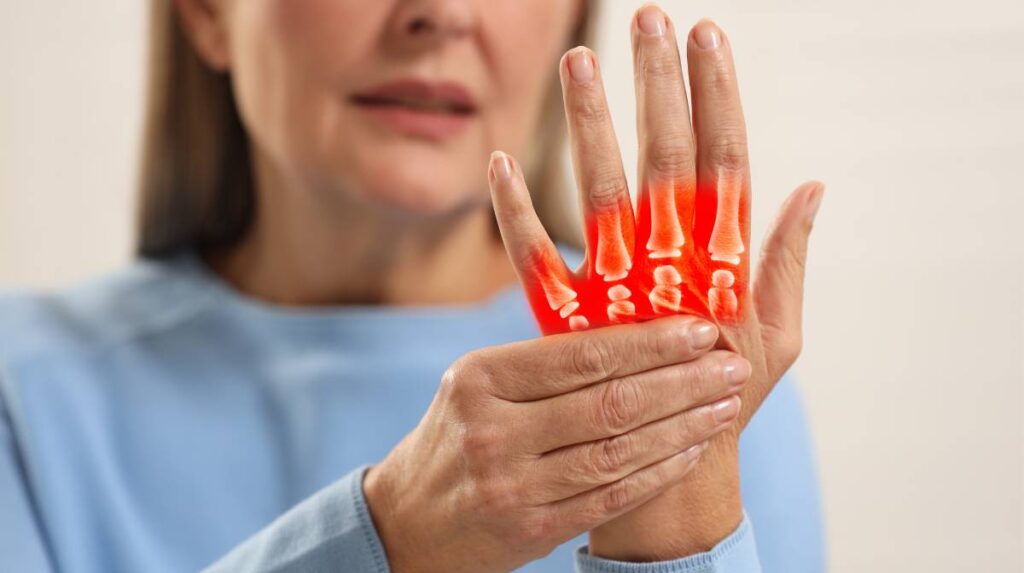 Rheumatoid Arthritis